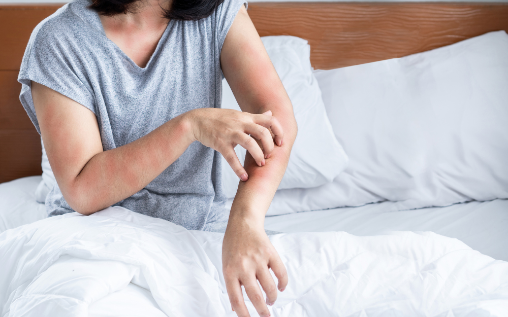 Skin & Allergic Conditions